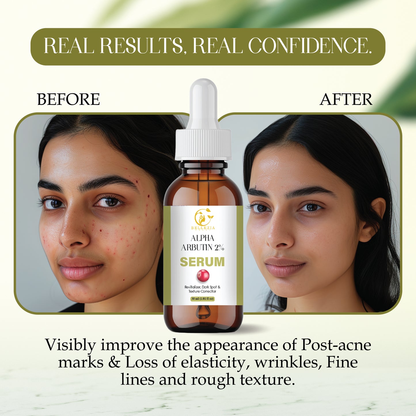 Alpha Arbutin Serum for Dark Spots, Pigmentation & Skin Brightening | Hydrating & Even Skin Tone Face Serum | Suitable for All Skin Types – 30ml