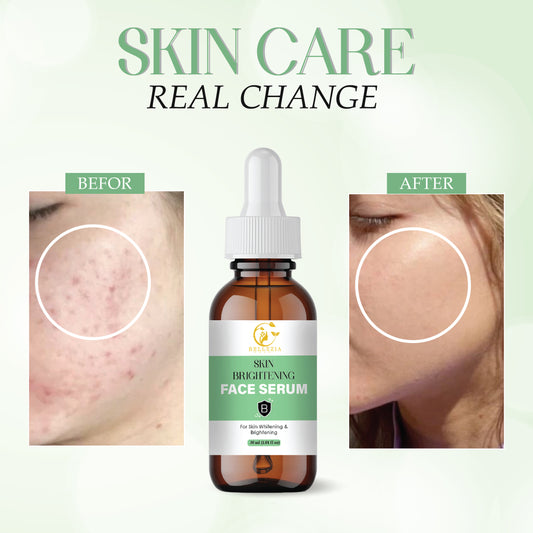 Skin Brightening Face Serum with Vitamin C, Niacinamide & Hyaluronic Acid | Dark Spot Removal, Even Skin Tone & Radiant Glow | Lightweight, Non-Greasy, For Men & Women