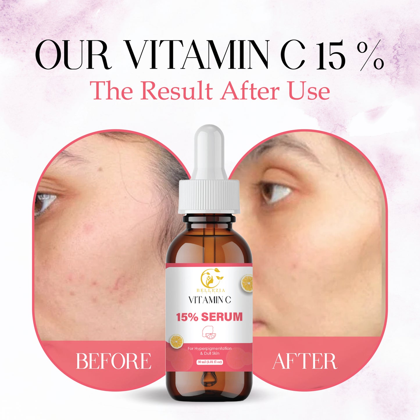 15% Vitamin Face Serum with Hyaluronic Acid & Antioxidants | Skin Brightening, Anti-Aging & Dark Spot Reduction | Hydrating Facial Serum for Glowing, Even-Toned Skin